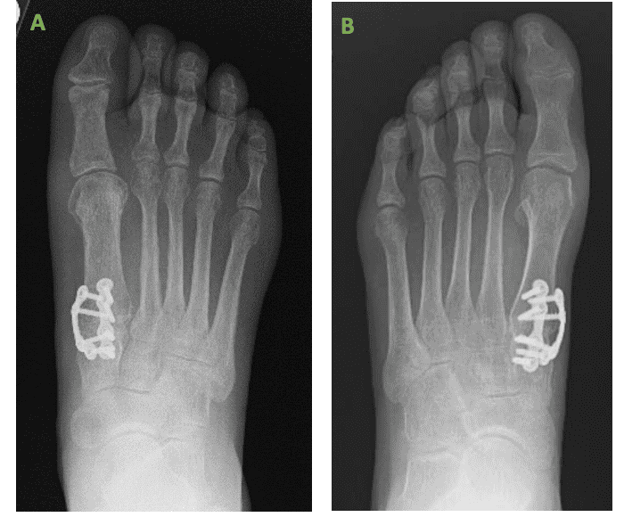 Screen Shot 2023 01 18 At 1.28.41 Pm Ossio – Naturally Transformative Bone Healing