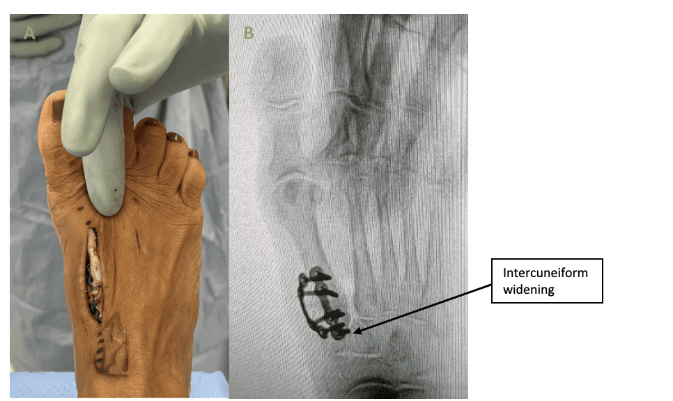 Screen Shot 2023 01 23 At 10.59.20 Am Ossio – Naturally Transformative Bone Healing