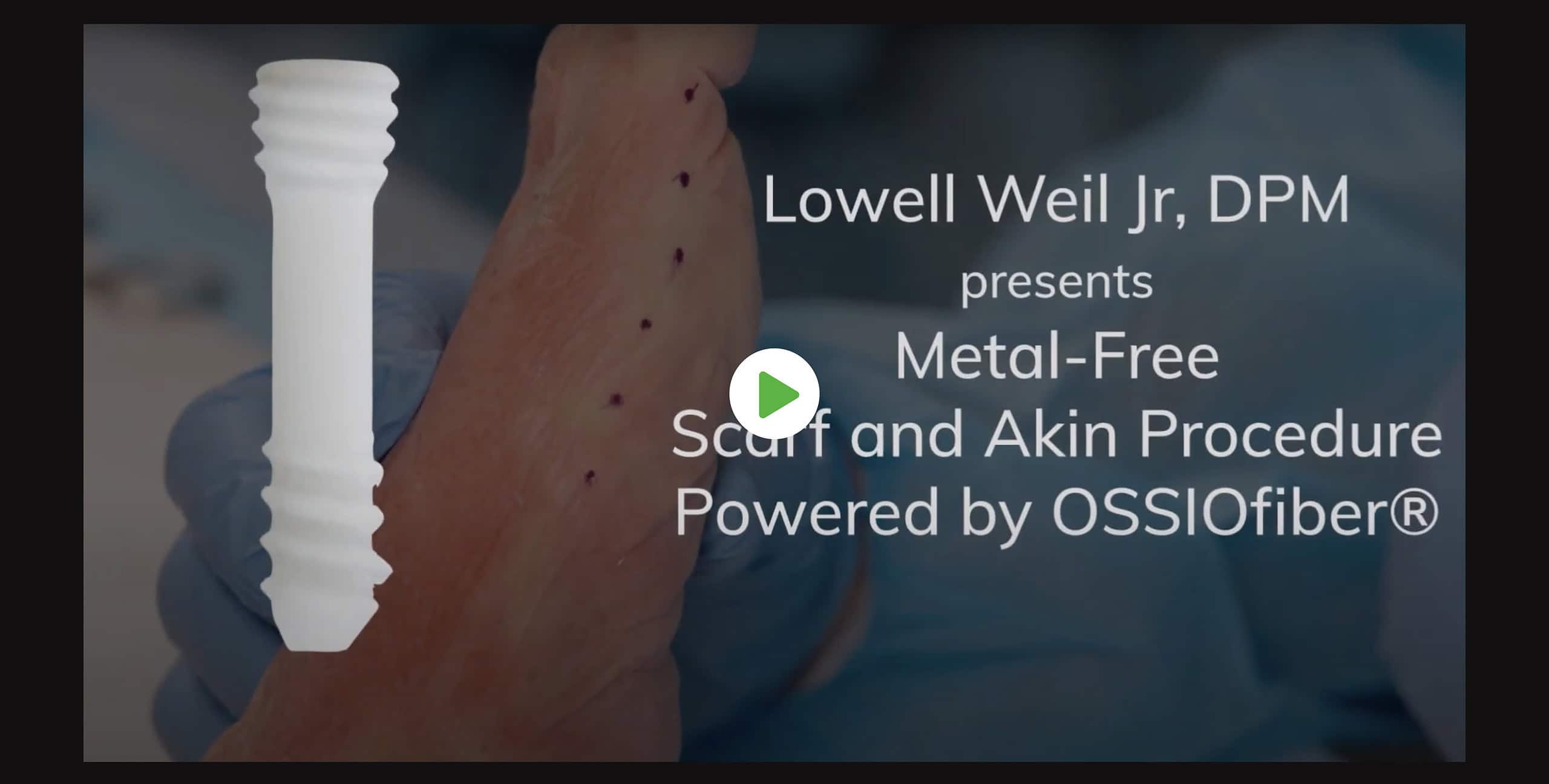 Scarf Procedure Scaled Ossio – Naturally Transformative Bone Healing