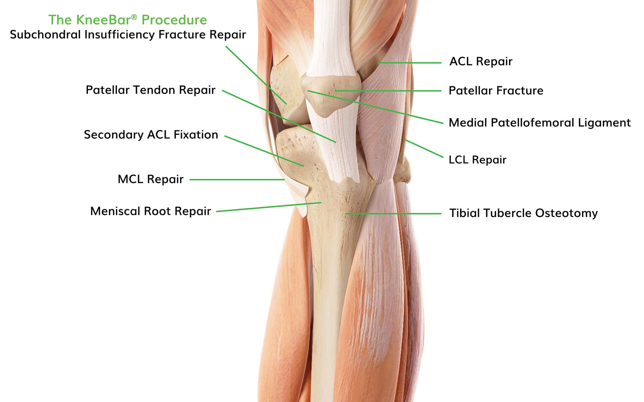 Img 6134 Scaled Ossio – Naturally Transformative Bone Healing