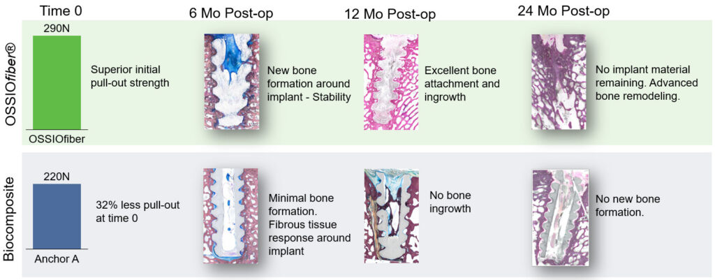 Key Observations From Published Literatureon Bone Response In Hand &Amp; Wrist Surgery 2 Ossiofiber® Bio- Integration Timeline