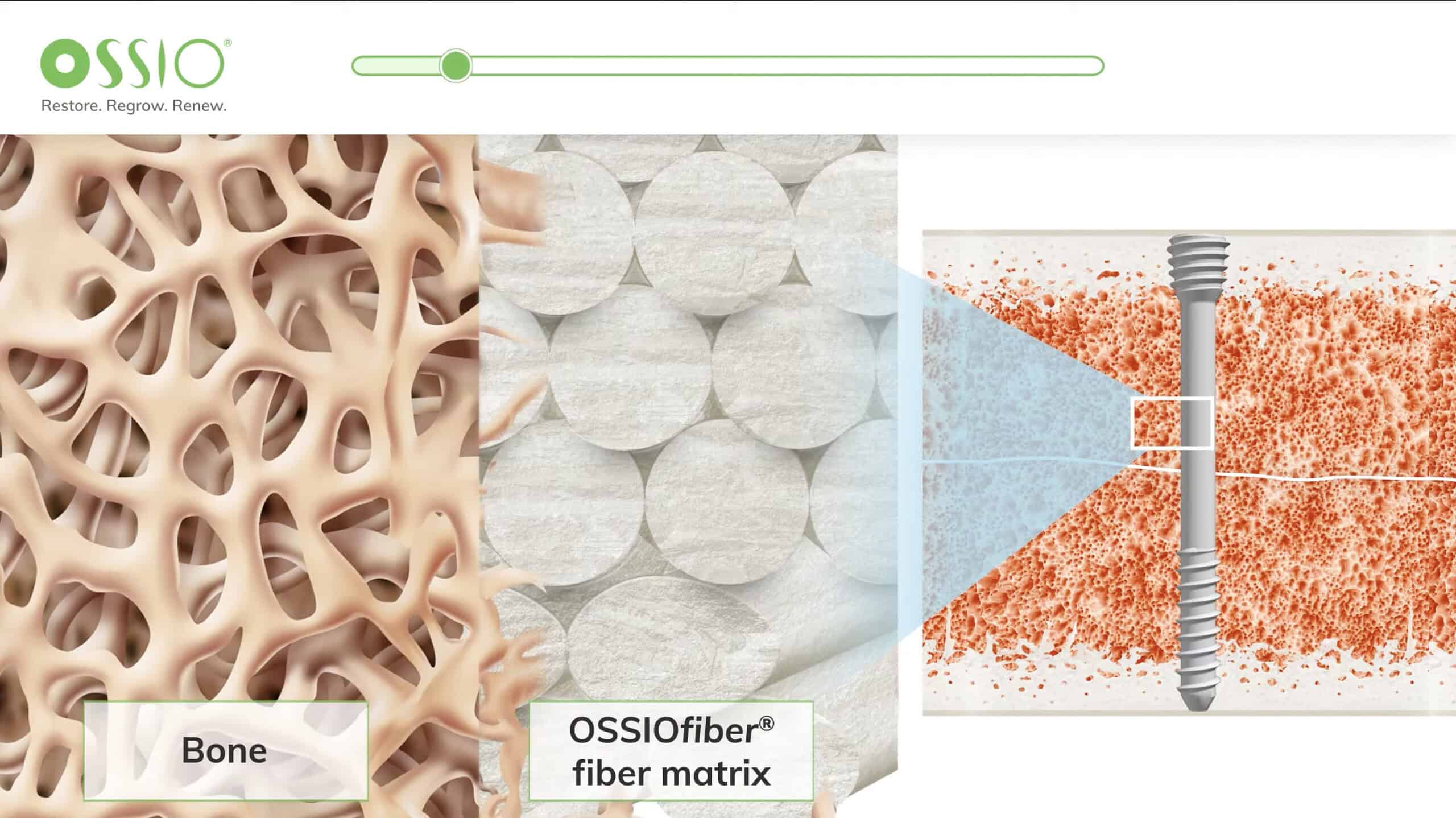 4115F2F07161Ca085Be896Ea3603A18568794955 1 Scaled Ossio – Naturally Transformative Bone Healing